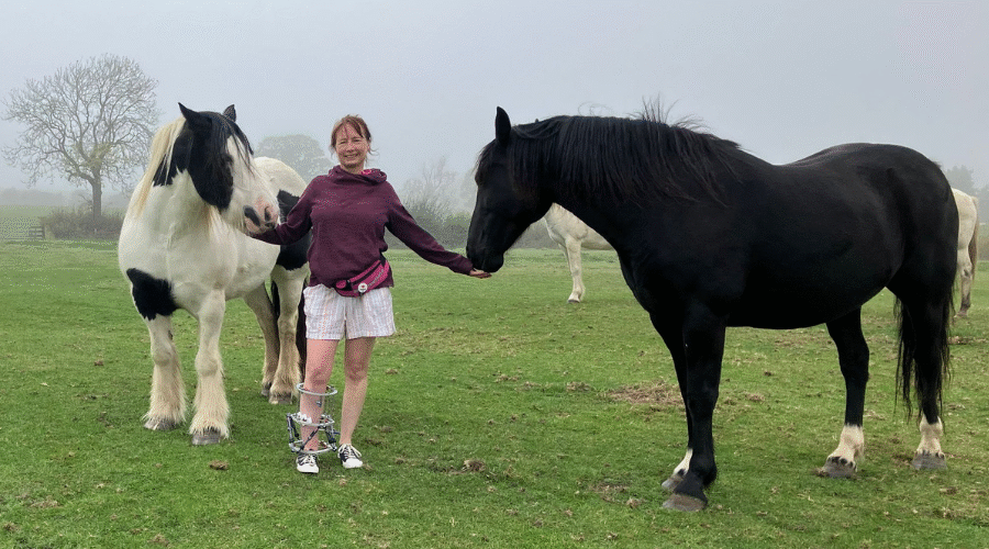 Nicola Turner with her horses, and an external fixation frame fitted to her leg to aid the healing of a fracture.